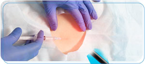 Lumbar Epidural Steroid Injection Specialist Near Me in Wilkes-Barre, PA Lumbar Epidural Steroid Injection Specialist Near Me in Wilkes-Barre, PA