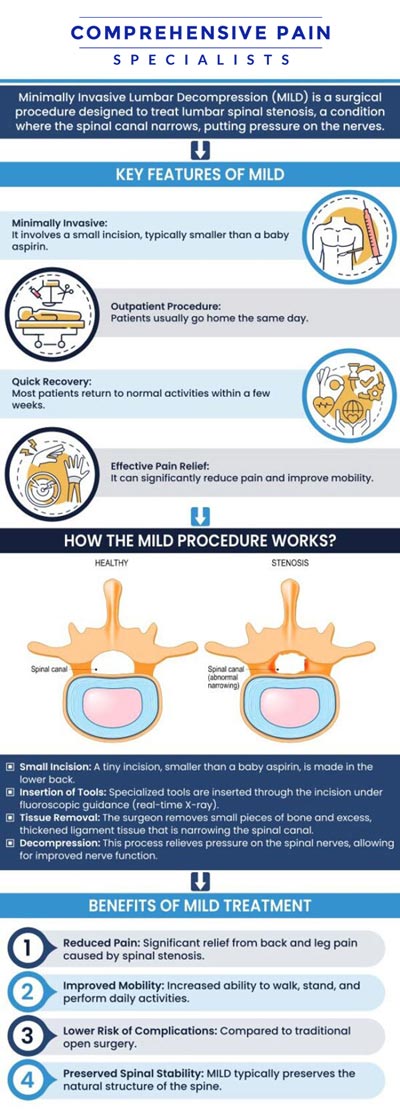 Common questions asked by patients: What is done during the mild procedure? Is the mild procedure worth it? Who is a candidate for the mild procedure? How many years does a mild procedure last? For more information, contact us or book an appointment online. We are located at 1177 PA-315, Dolphin Plaza, Wilkes-Barre, PA 18702. We serve patients from Wilkes-Barre PA, Glen Lyon PA, Dallas PA, Pittston PA, Mountain Top PA, Plymouth PA, and surrounding areas.
