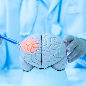 Head Injuries Treatment Near Me in Wilkes-Barre, PA