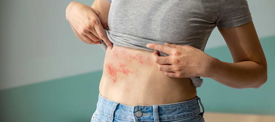 Postherpetic Neuralgia Treatment Specialist Near Me in Wilkes-Barre, PA