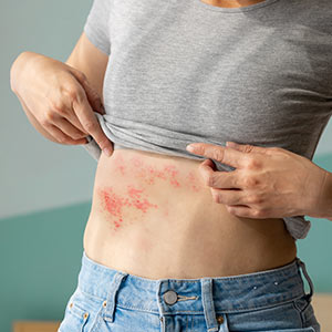 Postherpetic Neuralgia Treatment Near Me in Wilkes-Barre, PA