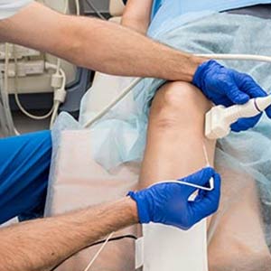 Radiofrequency Ablation Near Me in Wilkes-Barre, PA